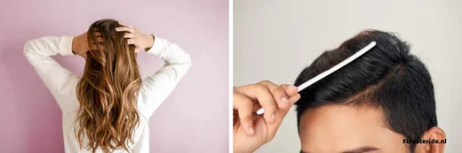 Collageen voor sterk haar - Finasteride.nl